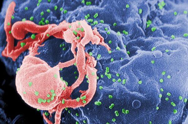 Mutant HIV complicates disease monitoring, distracts immune system from the functional virus