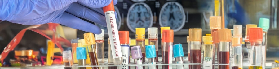EU-funded researchers are developing a new test for Alzheimer’s that could result in earlier detection and treatment. © digicomphoto, Shutterstock.com