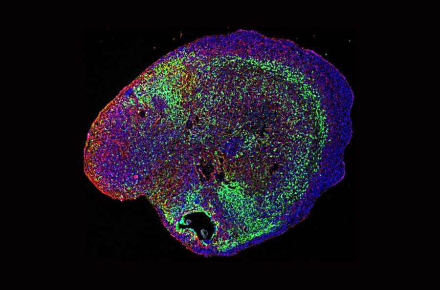 Brain organoid