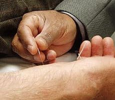 Acupuncture lowers stress protein in tests