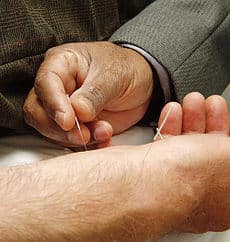 Acupuncture lowers stress protein in tests