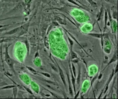 Stem cells derived from amniotic tissues have immunosuppressive properties
