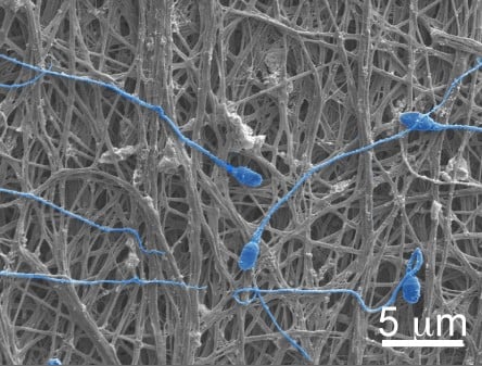 The electrospun fibers can release chemicals or they can physically block sperm, as shown here.