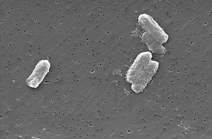 &#8216;Lonely&#8217; bacteria increase risk of antibiotic resistance