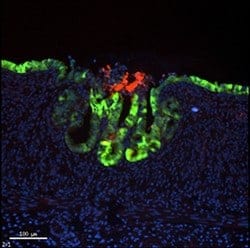 Stem cells converted to living intestinal patches