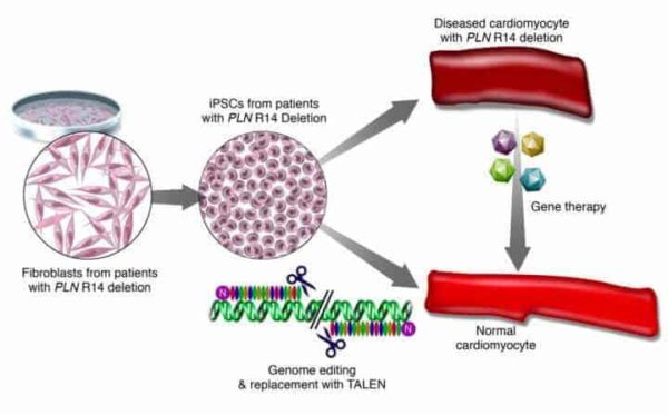 Gene Therapy Clips Out Heart Failure Causing Gene Mutations ...