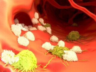 Researchers link HIV susceptibility to little-understood immune cell class
