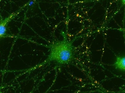 Umbilical Cells Help Eye’s Neurons Connect