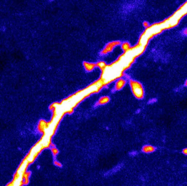 ‘Hunger’ neurons in the brain are regulated by protein activated during fasting