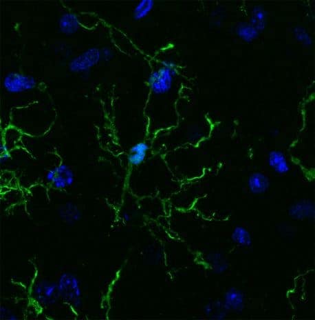 Brain’s immune cells linked to Alzheimer’s, Parkinson’s, schizophrenia