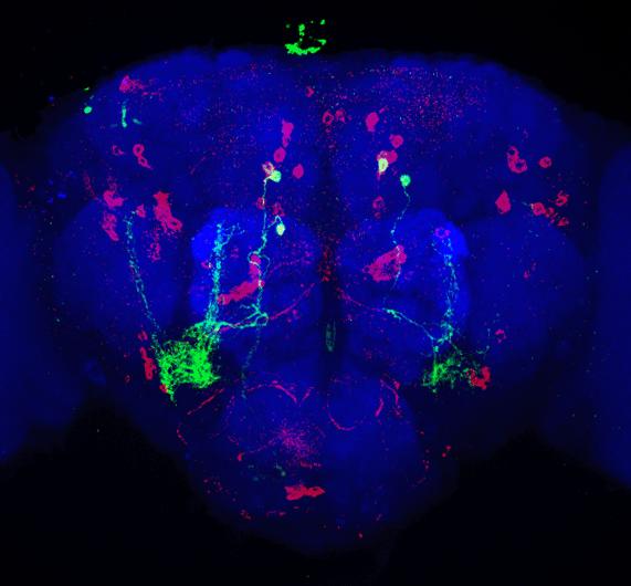 Study beefs up support for brain cells that control protein hunger