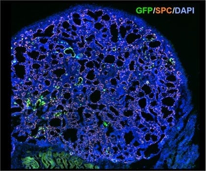 New lung 'organoids' in a dish mimic features of full-size lung