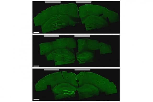 A noninvasive method for deep brain stimulation