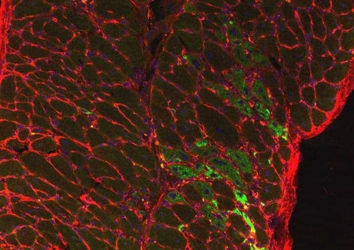 Researchers aim to repurpose former experimental cancer therapy to treat muscular dystrophy