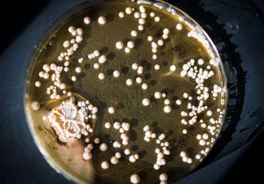 Bacteria in a dish