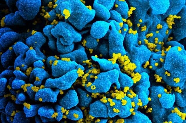 HIV virus closeup