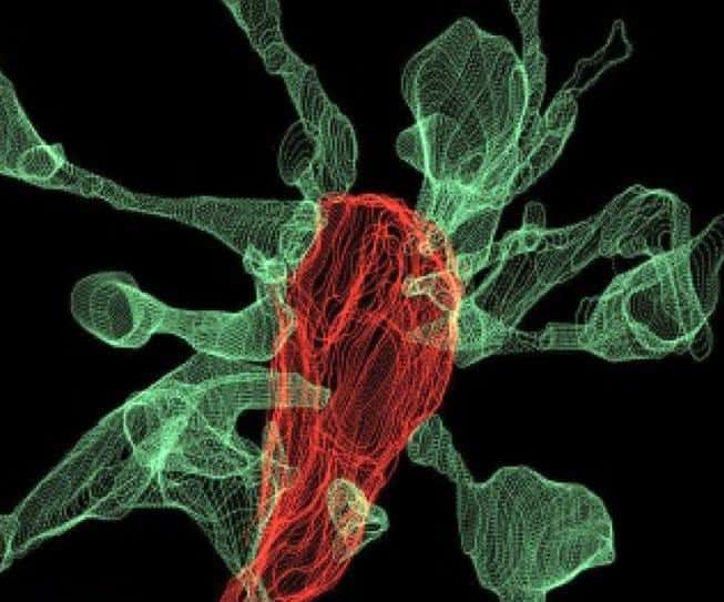Microglia: An emerging target in Alzheimer&#8217;s disease research