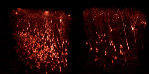 Rabies virus helps Alzheimer’s treatment cross blood-brain barrier