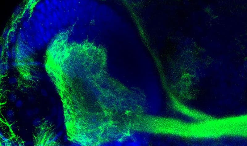 The eye of a zebrafish embryo deficient in NADPH oxidase 2 has an enlarged ganglion cell layer (green) and altered innervation of the brain, which leads to problems with signaling between the eyes and the brain.