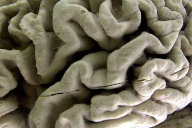 Life experience changes structure of brain