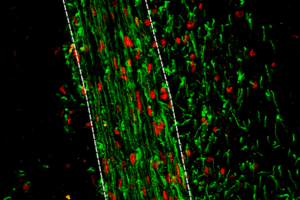 New drug target for remyelination in MS