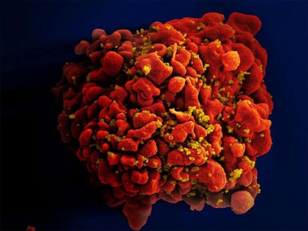 researchers-use-exosome-based-strategy-to-block-hiv-in-mice