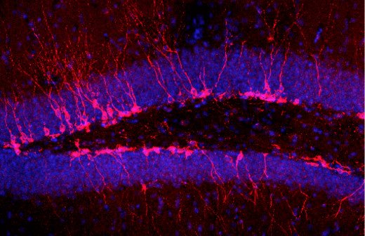 Young adult-born neurons in the hippocampus (pink) surrounded by mature cells (blue). Image courtesy of René Hen/Columbia University.