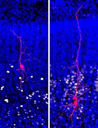 Biocytin-filled excitatory projection neurons in upper (left) and deep (right) layers of human cortex during in utero development. The study found disproportionally larger number of genes dysregulated in the upper versus deep-layer cortical projection neurons, suggesting these cell type and therefore cortico-cortical communication may be specifically affected in ASD. Credit: Chen & Kriegstein, Science 2015/AAAS.