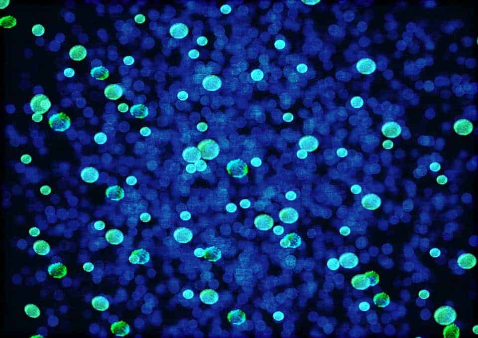 Microbes