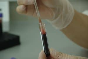 Blood test