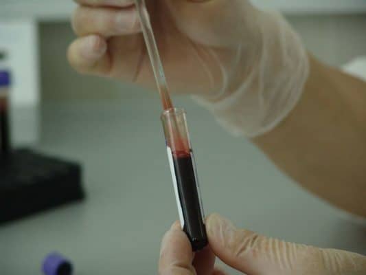 Blood test