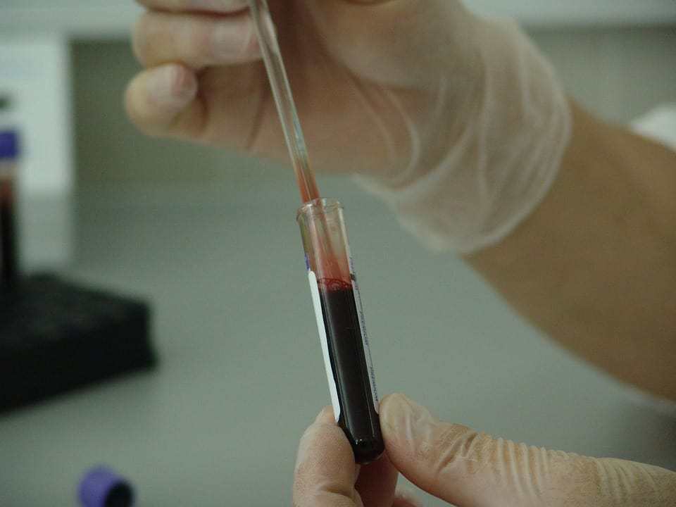 Blood test