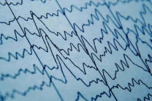 brain waves print out