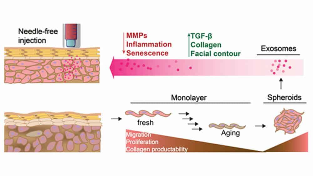 Monolayer dermal fibroblasts were cultured into spheroids, then exosomes were collected and delivered by a needle-free injector for skin aging treatment.