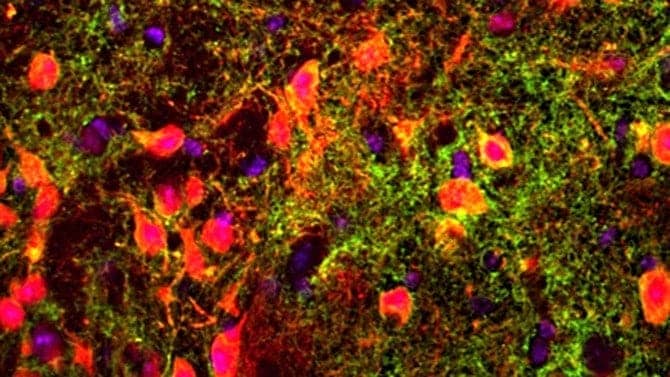 Gene links short-term memory to unexpected brain area