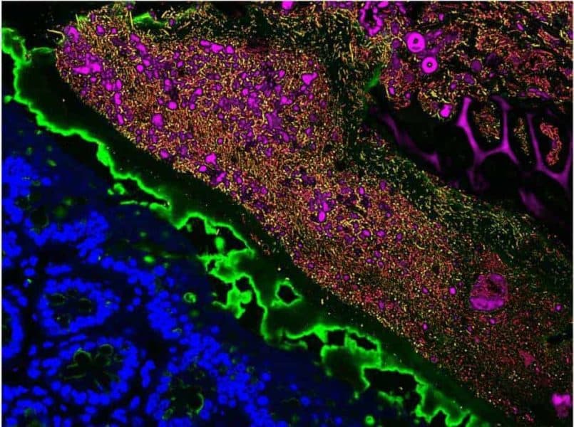 Princeton researchers Amir Erez, Jaime Lopez, Ned Wingreen and colleagues model how species diversity in a bacterial community is affected when the nutrients the microbes depend upon are only seasonally available. Here, bacterial and mouse gut cells are labeled with fluorescent markers. Photo by KC Huang, Biophysics, Stanford University