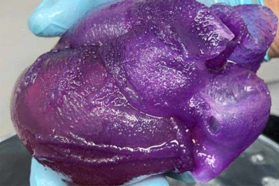 3D Bioprinted Heart Provides New Tool for Surgeons