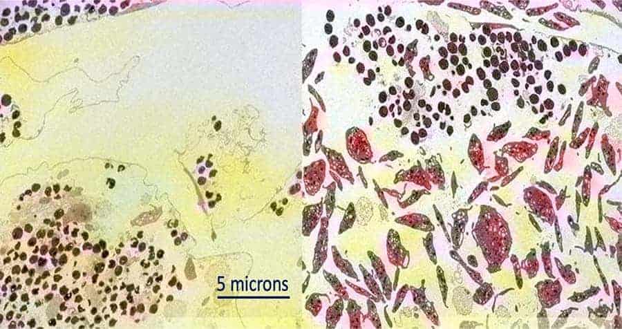 Left: Human platelets are destroyed by Staphylococcus aureus bacteria (circles). Right: With the addition of blood thinner ticagrelor, human platelets (larger blobs) are protected from injury by Staphylococcus aureus (smaller circles).