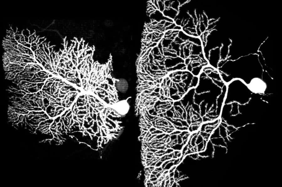 Growing neurons gain an edge by making connections