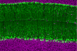 Purkinje cells (green) in a normal mouse brain. Image courtesy of Sarah Donofrio/Amanda Brown/Sillitoe lab.
