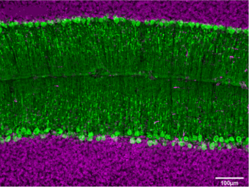 Purkinje cells (green) in a normal mouse brain. Image courtesy of Sarah Donofrio/Amanda Brown/Sillitoe lab.
