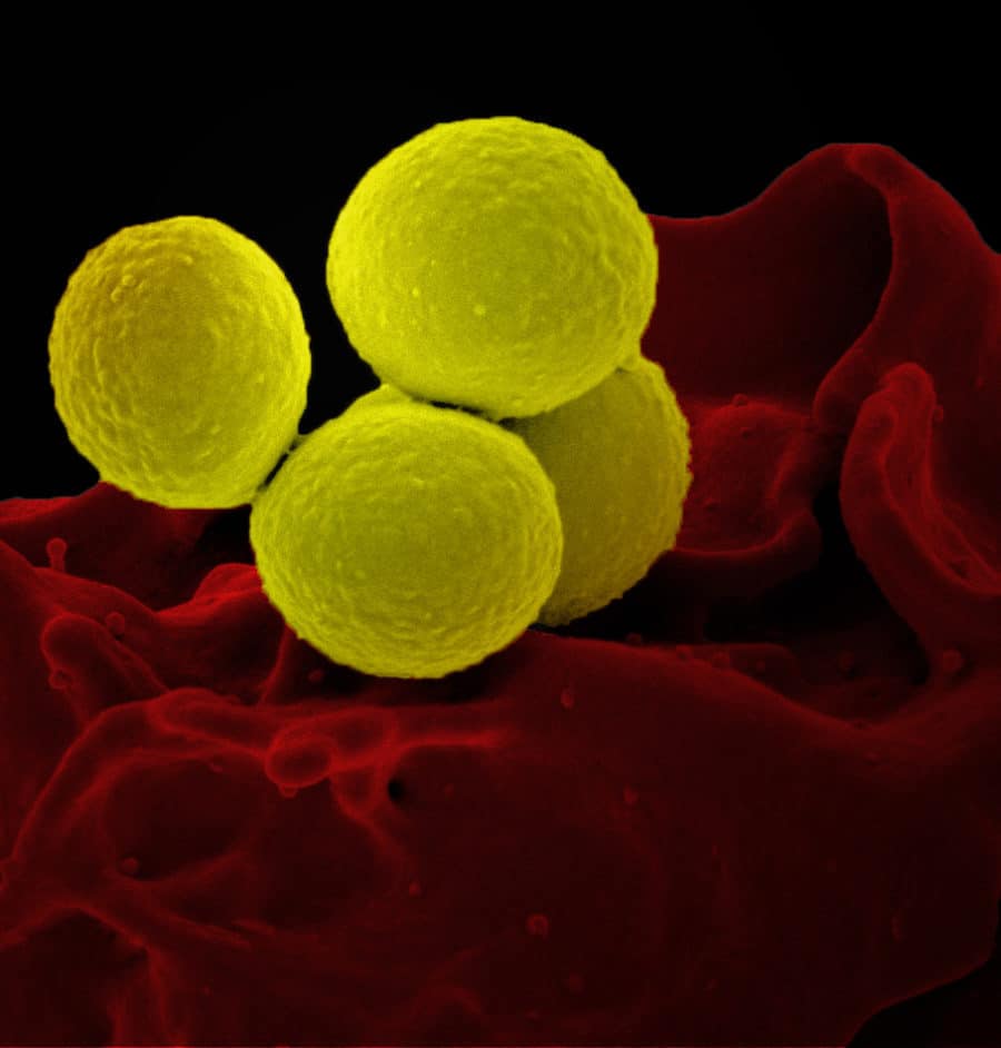 Trial of existing antibiotic for treating Staphylococcus aureus ...