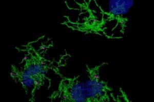 A team of scientists have found the gene expression signatures underlying microglia associated with amyloid plaque phagocytosis - i.e. the engulfing of deposits of the amyloid beta (Aβ) protein in the brain.