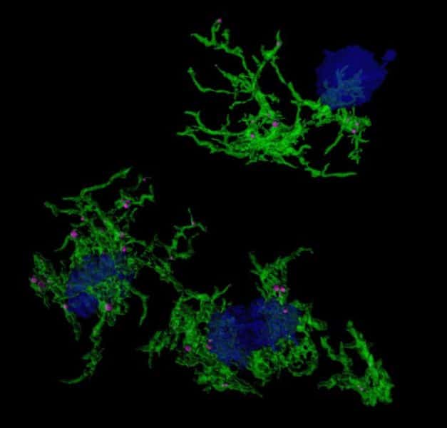 A team of scientists have found the gene expression signatures underlying microglia associated with amyloid plaque phagocytosis - i.e. the engulfing of deposits of the amyloid beta (Aβ) protein in the brain.