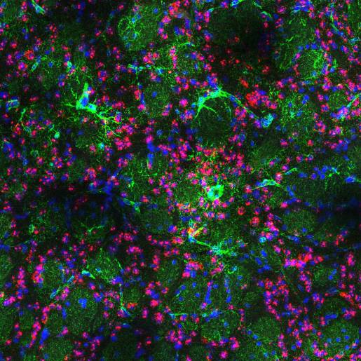Glial cells help mitigate neurological damage in Huntington’s disease