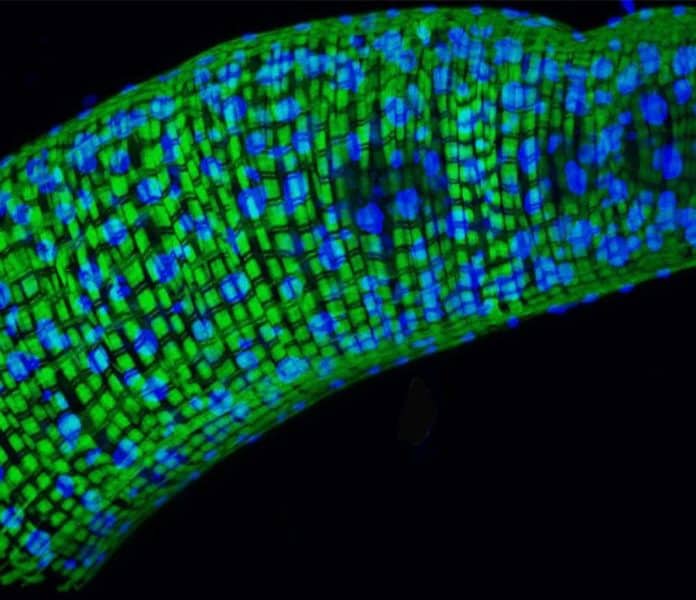 In a study of Drosophila fruit flies, NIH scientists found that only about 30% of the genes that are hallmarks for aging may set an animal's internal clock. The rest may reflect the body's response to bacteria. Above is a picture of a Drosophila gut, a key source of bacteria.