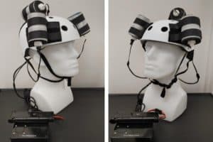 Device helmet with 3 oncoscillators securely attached. The oncoscillators are connected to a controller box powered by a rechargeable battery.