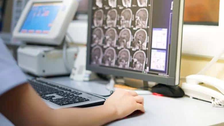 Researchers automate brain MRI image labelling, more than 100,000 exams can be labelled in less than 30 minutes