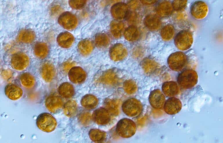 “Yellow cells” of the symbiotic algae, Philozoon collosum, isolated from the soft coral, Capnella gaboensis, collected off the east coast of southern Australia. IMAGE: Matthew R. Nitschke