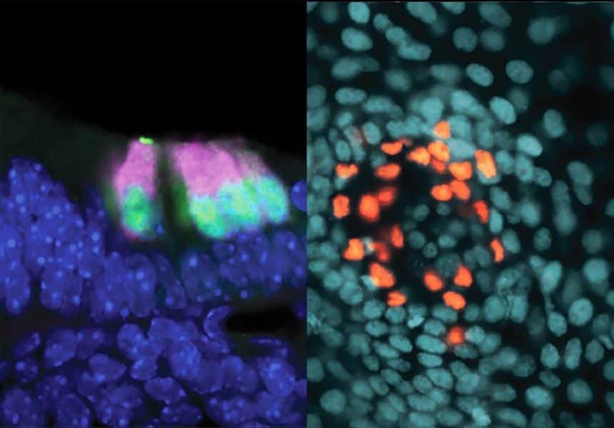 Inner ear sensory cells (left) and skin sensory cells from a one-day-old mouse (Image by Vincent Yu/Segil Lab/USC Stem Cell)